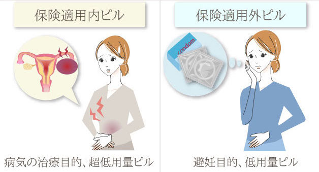 ピルの保険適用について