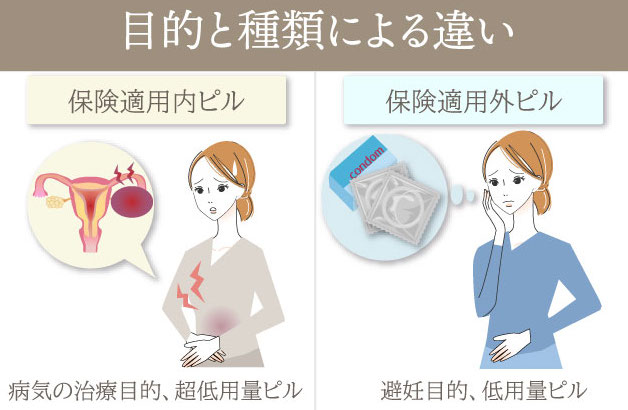 ピルの保険適用による違い