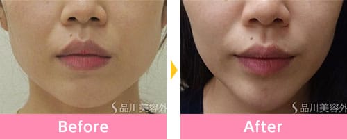 品川美容外科の症例画像