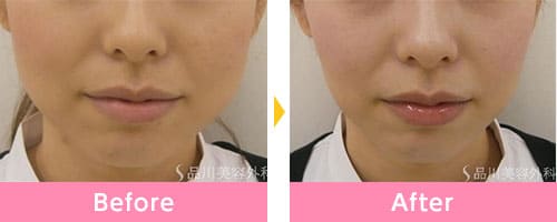 品川美容外科の症例画像