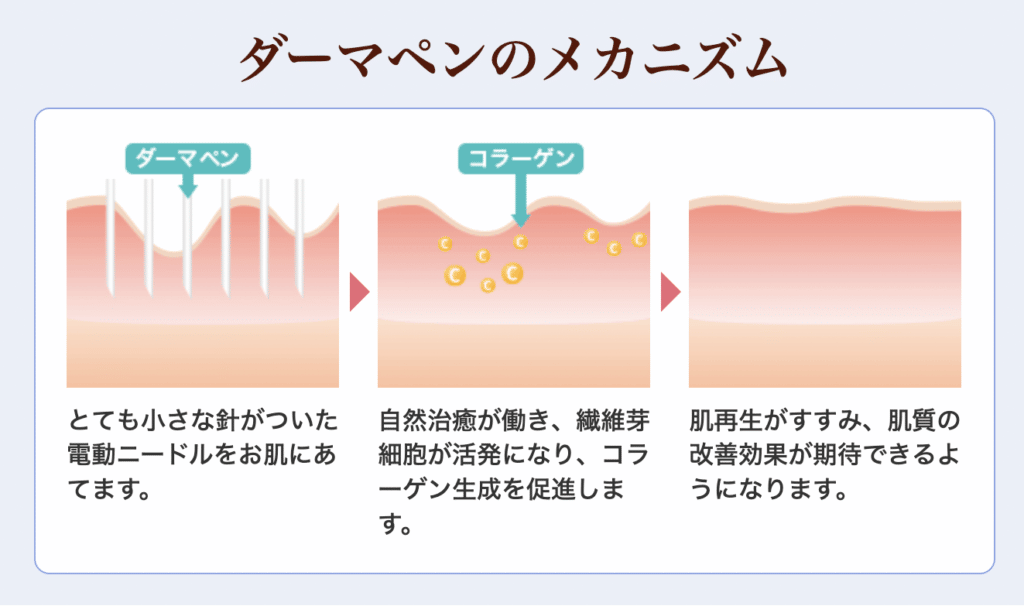 ダーマペンの仕組み