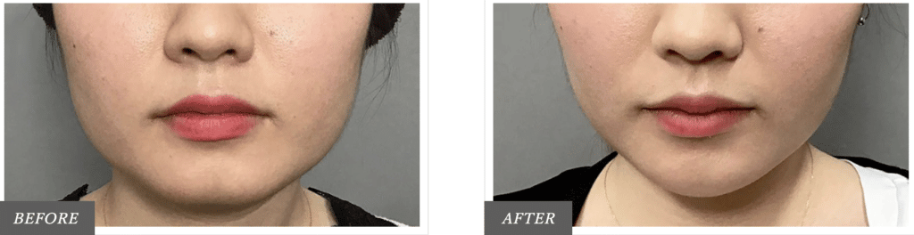 東京中央美容外科の症例画像