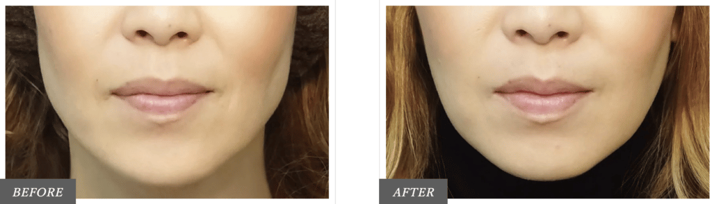 東京中央美容外科の症例画像