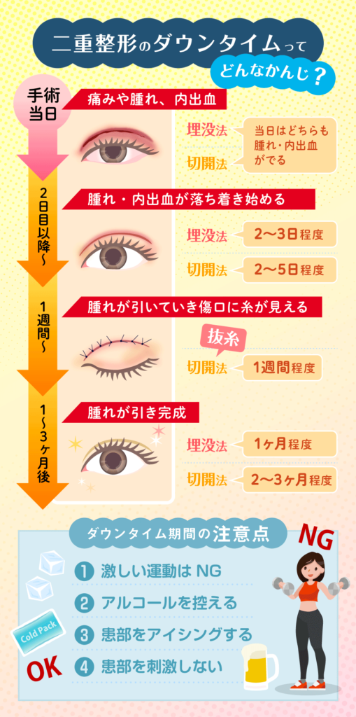 二重整形のダウンタイム期間は1週間〜1ヶ月程度
