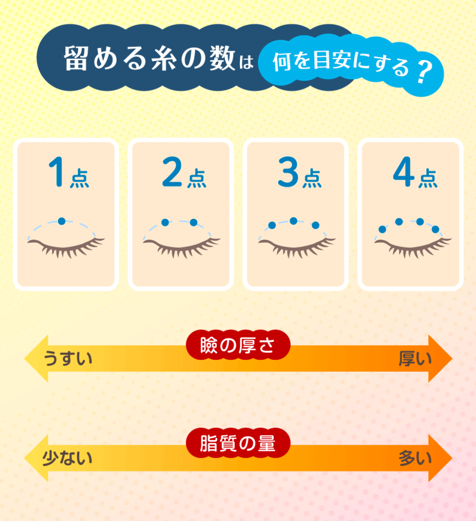 糸を留める数は希望の二重の形やまぶたの厚みによって変わる
