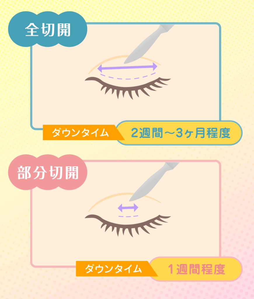 切開法は皮膚を切って強固な二重に!